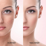 Lumora Beauty Elektrische Gesichtsreinigungsbürste - Vorher Nachher