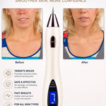 Lumora Beauty™ – Plasma Skin Renewal Pen