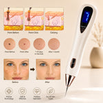 Lumora Beauty™ – Plasma Skin Renewal Pen